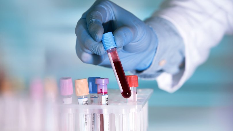 İngiltere kanserin erken teşhisi için dünyanın en büyük kan testini yapacak!
